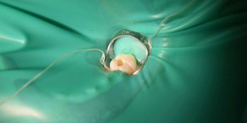 Лечение глубокого кариеса жевательного зуба фото до лечения